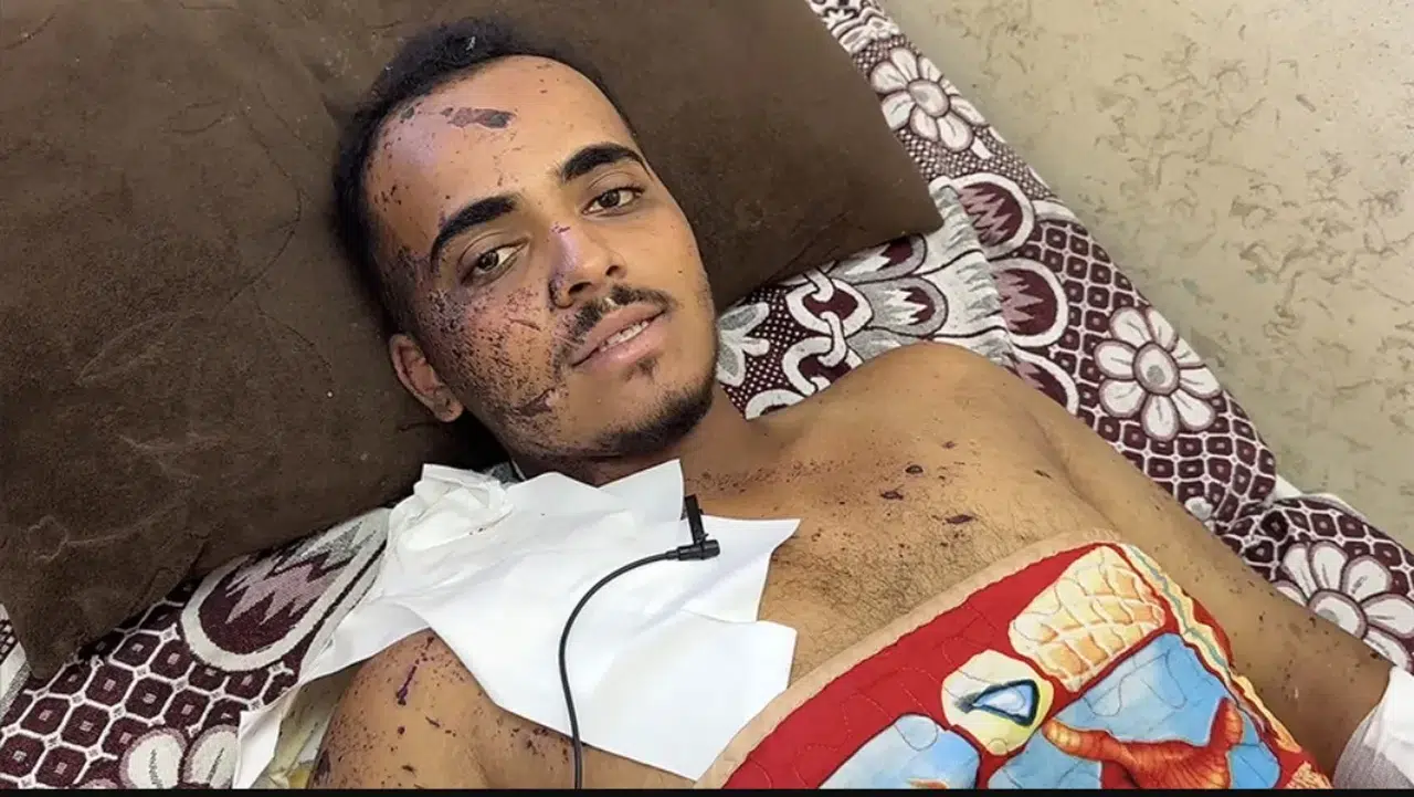 Gerçeği dünyaya duyurmak istedi, İsrail bombalarıyla ampüte oldu