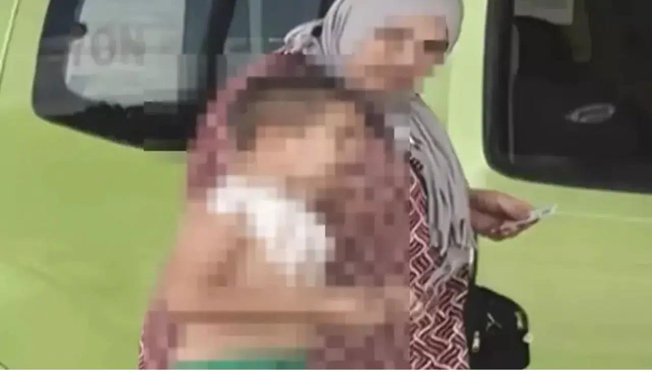 7 yaşındaki çocuk çakmaktan yaralandı