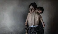 Gazze'de insani kriz: 361 kişi açlıktan vefat etti!