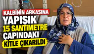 Kalbinin arkasına yapışık 15 santimetre çapındaki kitle çıkarıldı