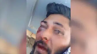 Taciz şüphelisini dövüp, jandarmaya teslim ettiler