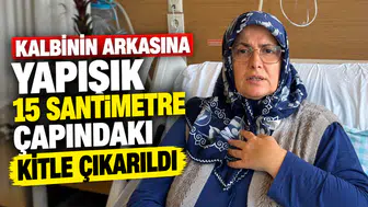 Kalbinin arkasına yapışık 15 santimetre çapındaki kitle çıkarıldı