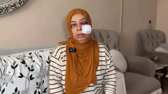 Kapağı kırık rögara düştü