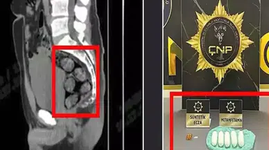 Midesinde 173,15 gram metamfetamin bulundu