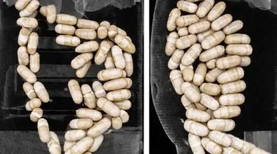 2 şüphelinin midesinden 127 kapsül uyuşturucu çıktı