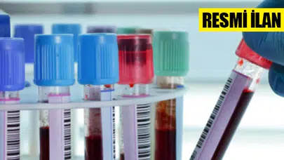 ÇOCUK HASTALIKLARI MONOKLONAL ANTİKOR TESTLERİ ALIMI İHALESİ