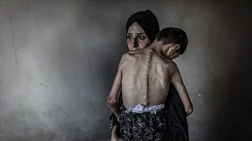 Gazze'de insani kriz: 361 kişi açlıktan vefat etti!