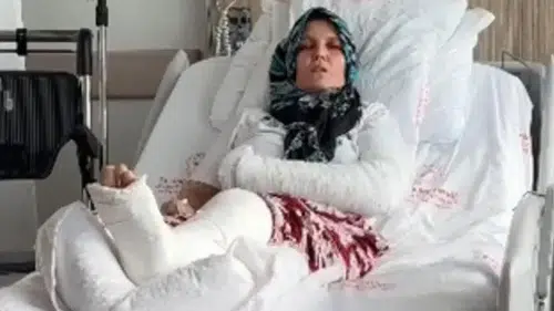 Kavgada 3 çocuk annesinin kolu ve bacağı kırıldı
