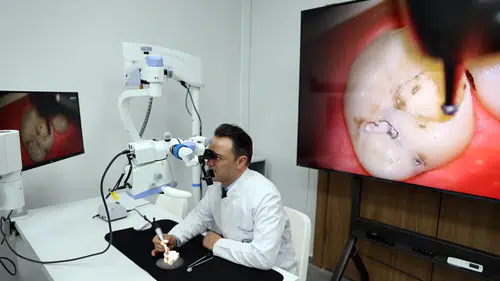 Dişe mikro düzeyde müdahale dayanım ömrünü artırıyor