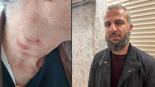 Konya'da doktoru darp eden müezzin tutuklandı!