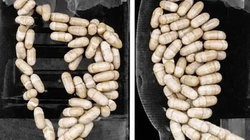 2 şüphelinin midesinden 127 kapsül uyuşturucu çıktı