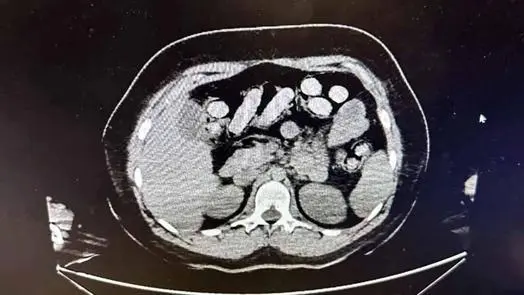 Midesinde 1,5 kilo metamfetaminle yakalanan 2 kadın kurye tutuklandı