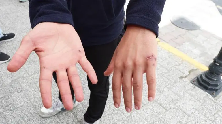 Eyüpsultanda çocukluk arkadaşı işçiler akıma kapıldı; 1 ölü, 1 yaralı